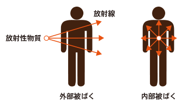 被ばく